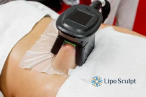 Does Fat Freezing At Home Work? 3 Fat freezing at home from Lipo Sculpt Chipping Norton